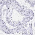 CCDC17 Polyclonal Antibody