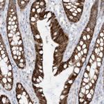 ETHE1 Antibody in Immunohistochemistry (Paraffin) (IHC (P))