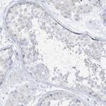 ETHE1 Antibody in Immunohistochemistry (Paraffin) (IHC (P))