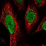 MSH6 Polyclonal Antibody