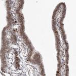 MSH6 Antibody in Immunohistochemistry (Paraffin) (IHC (P))