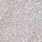MSH6 Antibody in Immunohistochemistry (Paraffin) (IHC (P))
