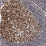 MSH6 Antibody in Immunohistochemistry (Paraffin) (IHC (P))