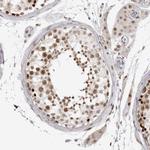 MSH6 Antibody in Immunohistochemistry (Paraffin) (IHC (P))