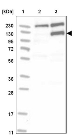 MSH6 Antibody in Western Blot (WB)