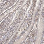 CSK Antibody in Immunohistochemistry (Paraffin) (IHC (P))