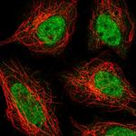 ZNF326 Polyclonal Antibody