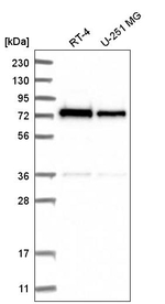 ZNF326 Antibody in Western Blot (WB)