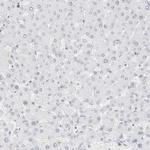 Torc2 Antibody in Immunohistochemistry (Paraffin) (IHC (P))
