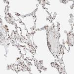 Torc2 Antibody in Immunohistochemistry (Paraffin) (IHC (P))