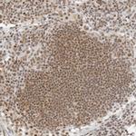 Torc2 Antibody in Immunohistochemistry (Paraffin) (IHC (P))