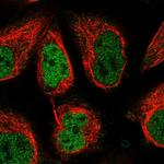 Torc2 Polyclonal Antibody