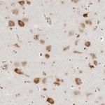 eIF4G Antibody in Immunohistochemistry (Paraffin) (IHC (P))