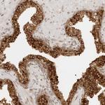 eIF4G Antibody in Immunohistochemistry (Paraffin) (IHC (P))