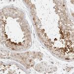 eIF4G Antibody in Immunohistochemistry (Paraffin) (IHC (P))