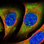 LIMK1 Antibody in Immunocytochemistry (ICC/IF)