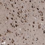 LIMK1 Antibody in Immunohistochemistry (Paraffin) (IHC (P))