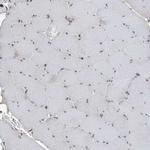 LIMK1 Antibody in Immunohistochemistry (Paraffin) (IHC (P))