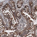 LIMK1 Antibody in Immunohistochemistry (Paraffin) (IHC (P))