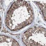 LIMK1 Antibody in Immunohistochemistry (Paraffin) (IHC (P))