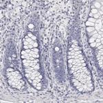 Carbonic Anhydrase VI Antibody in Immunohistochemistry (Paraffin) (IHC (P))