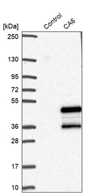 Carbonic Anhydrase VI Antibody in Western Blot (WB)