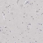 MATN1 Antibody in Immunohistochemistry (Paraffin) (IHC (P))