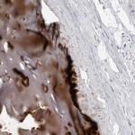 MATN1 Polyclonal Antibody