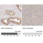 HK2 Antibody