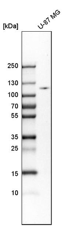 HK2 Polyclonal Antibody