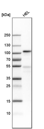 Transferrin Receptor Antibody in Western Blot (WB)