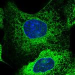 GBP5 Polyclonal Antibody