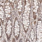 WRN Antibody in Immunohistochemistry (Paraffin) (IHC (P))