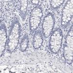 LPO Polyclonal Antibody