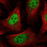 GABPA Polyclonal Antibody