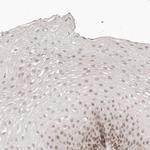 GABPA Antibody in Immunohistochemistry (Paraffin) (IHC (P))