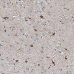 FABP7 Antibody in Immunohistochemistry (Paraffin) (IHC (P))