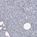 FABP7 Polyclonal Antibody