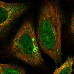 AP2 alpha Polyclonal Antibody