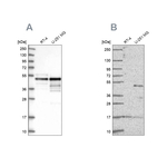 AP2 alpha Antibody in Western Blot (WB)