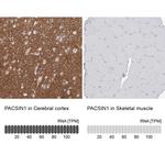 PACSIN1 Antibody