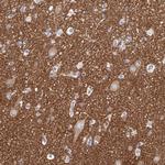 PACSIN1 Antibody in Immunohistochemistry (Paraffin) (IHC (P))