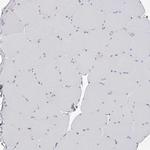 PACSIN1 Antibody in Immunohistochemistry (Paraffin) (IHC (P))