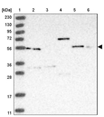 PACSIN1 Antibody in Western Blot (WB)