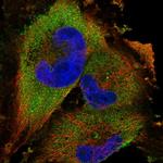 HIP2 Polyclonal Antibody