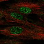 FOXF1 Polyclonal Antibody