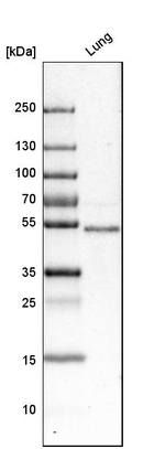 FOXF1 Antibody in Western Blot (WB)