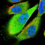 SBDS Antibody in Immunocytochemistry (ICC/IF)
