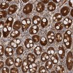SBDS Antibody in Immunohistochemistry (Paraffin) (IHC (P))