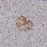 CD82 Antibody in Immunohistochemistry (Paraffin) (IHC (P))
